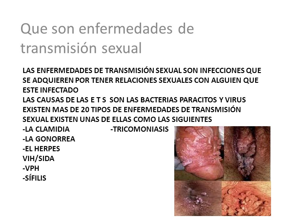 imagenes de tipos de infecciones de transmision sexualidad